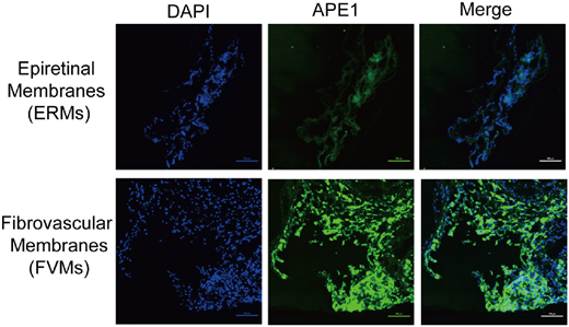 IOVS Journal tweet media
