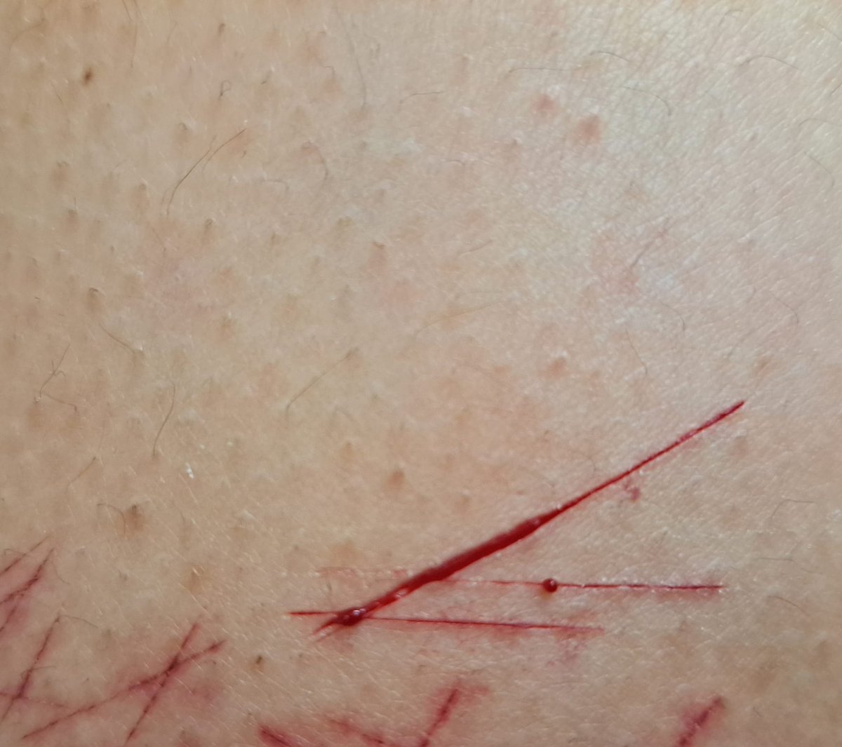 heartbreak and razorblades here's sum recent seshes i captured