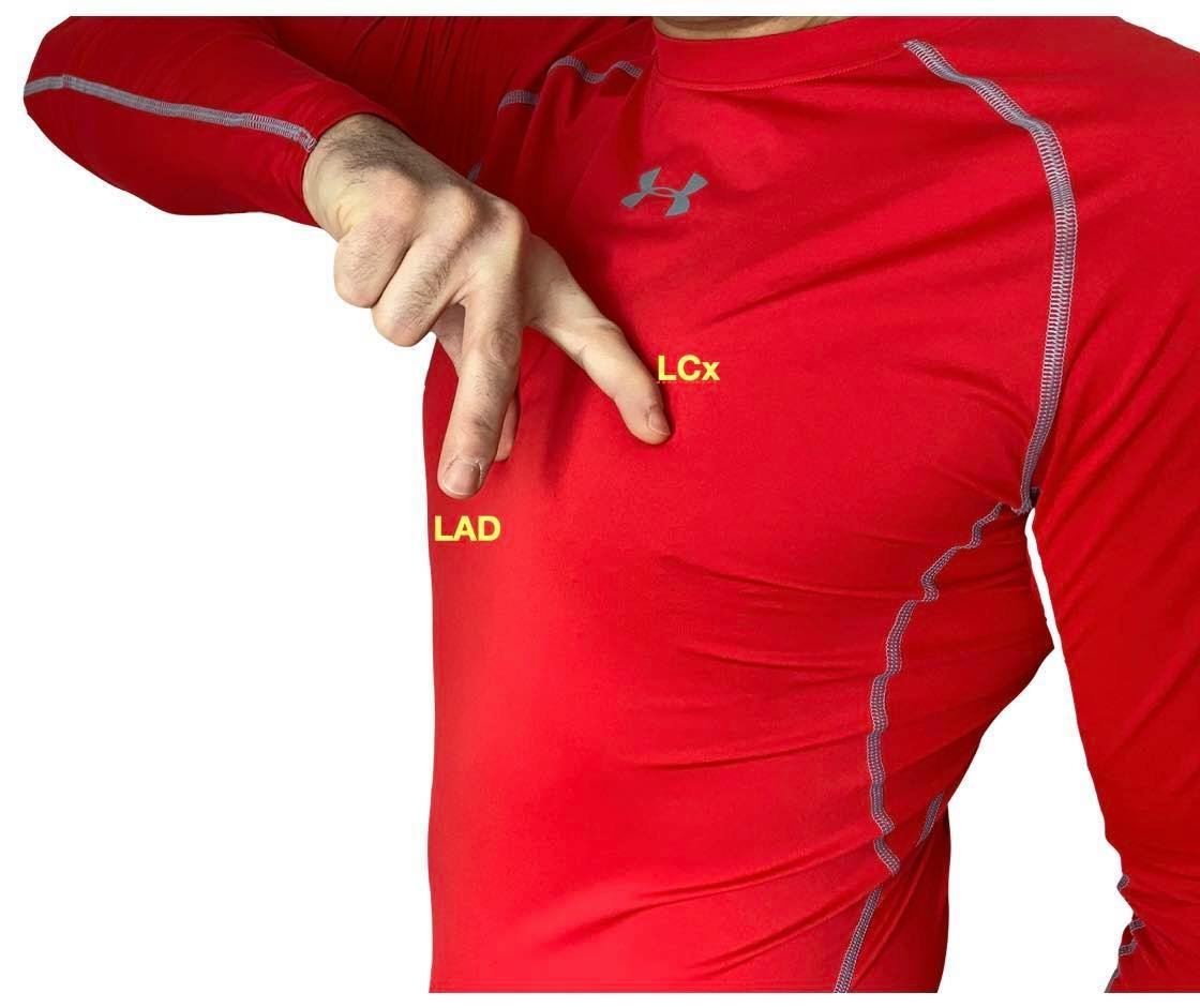 CardiovascularCorner tweet media