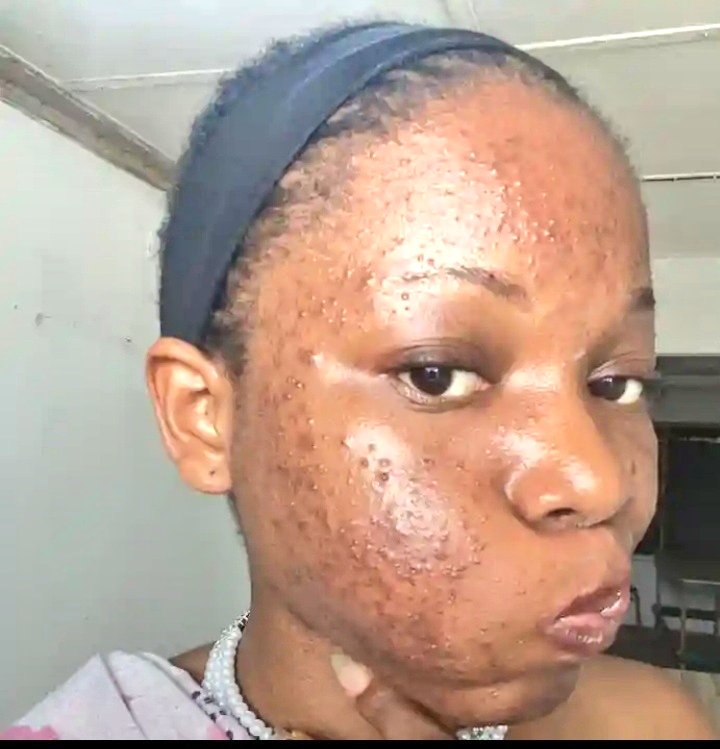 Mira👅🇳🇬 tweet media