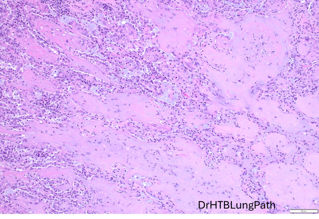 Humberto Trejo Bittar, MD, FCAP tweet media