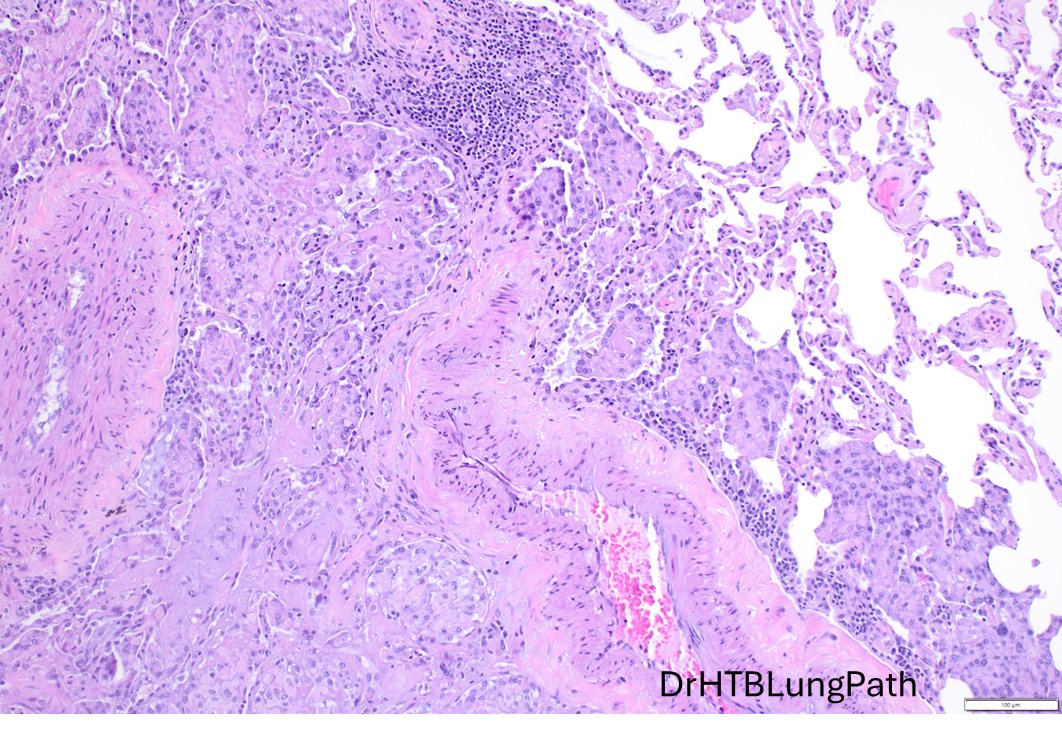 Humberto Trejo Bittar, MD, FCAP tweet media