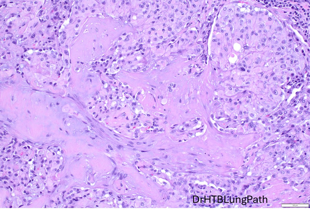 Humberto Trejo Bittar, MD, FCAP tweet media