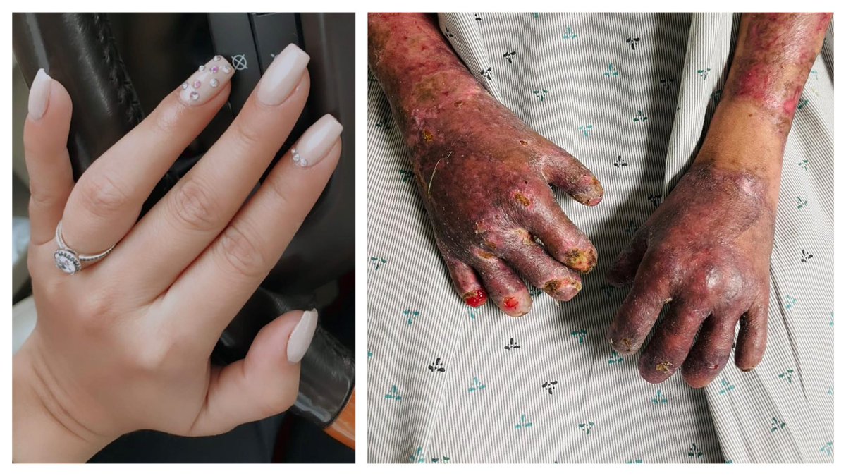 Wikichava tweet media