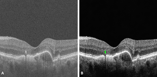 TVST Journal tweet media