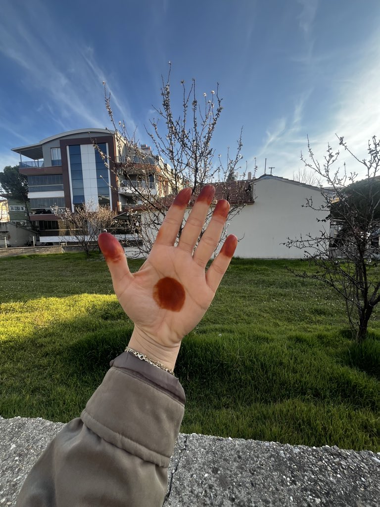 birgranduses's tweet photo. @hickimsedeilim Benimki Anadolu versiyonu 😅 https://t.co/f13ykuy12P