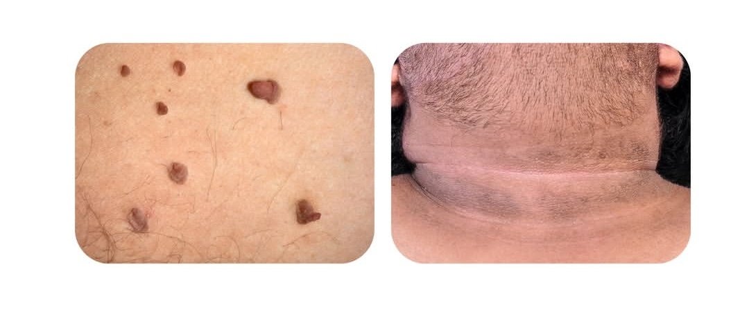 No filter Skin tweet media