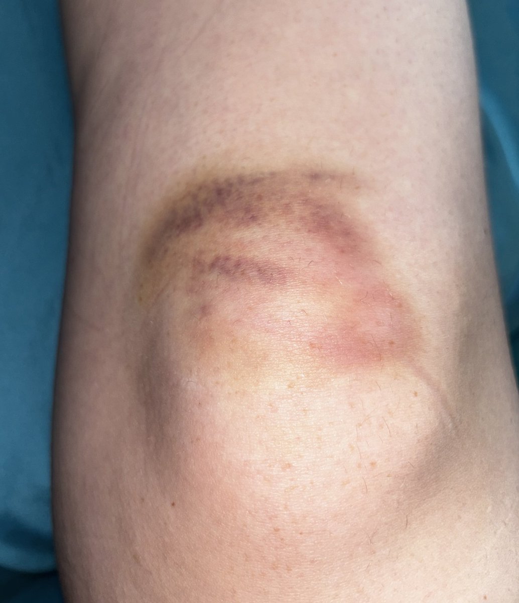 catelyn stark’s strongest soldier tweet media