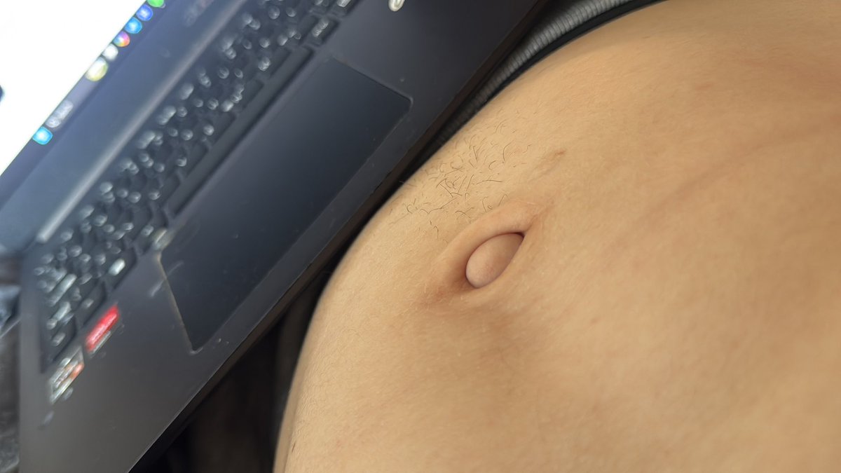 Jim Koopar tweet media