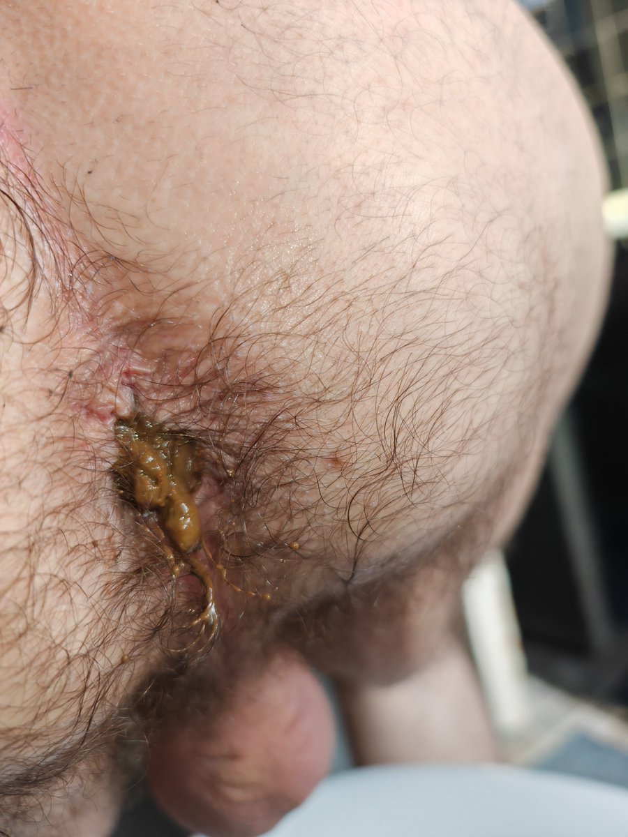 TheScatmastr 🇮🇪💸 tweet media