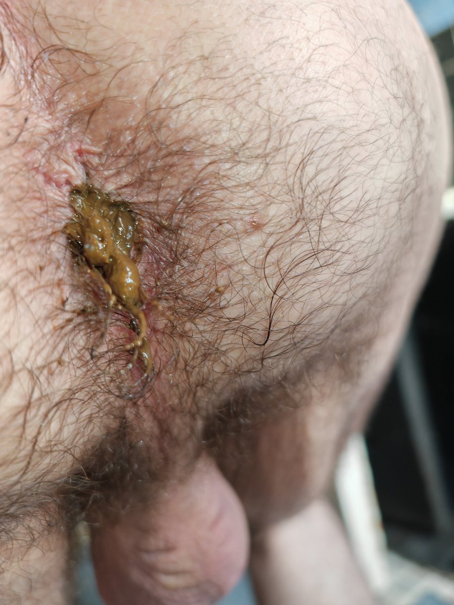 TheScatmastr 🇮🇪💸 tweet media