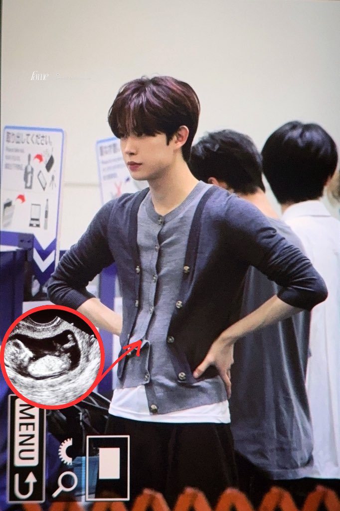 acervo ald1 tweet media