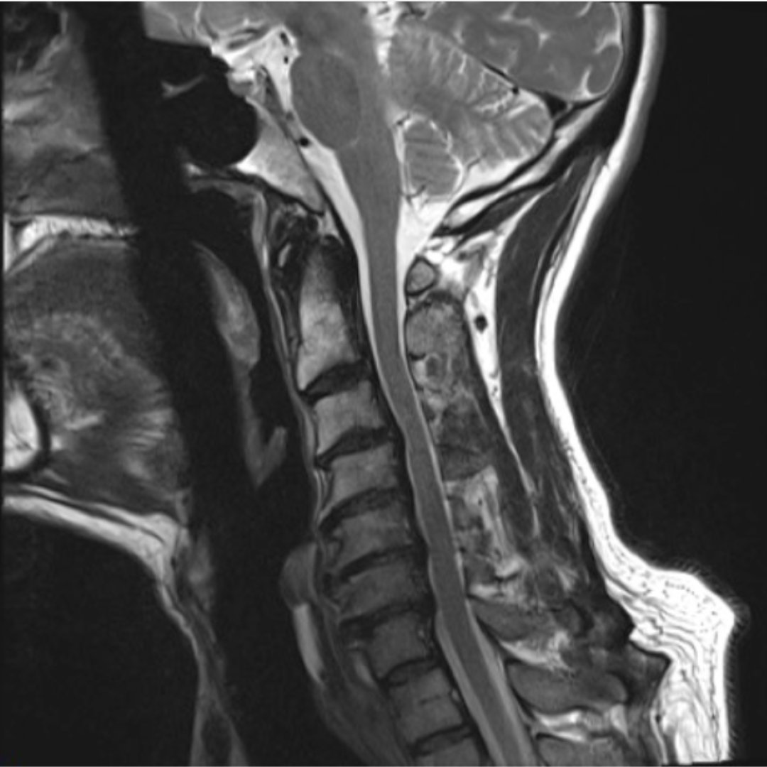 J Bone & Joint Surg tweet media