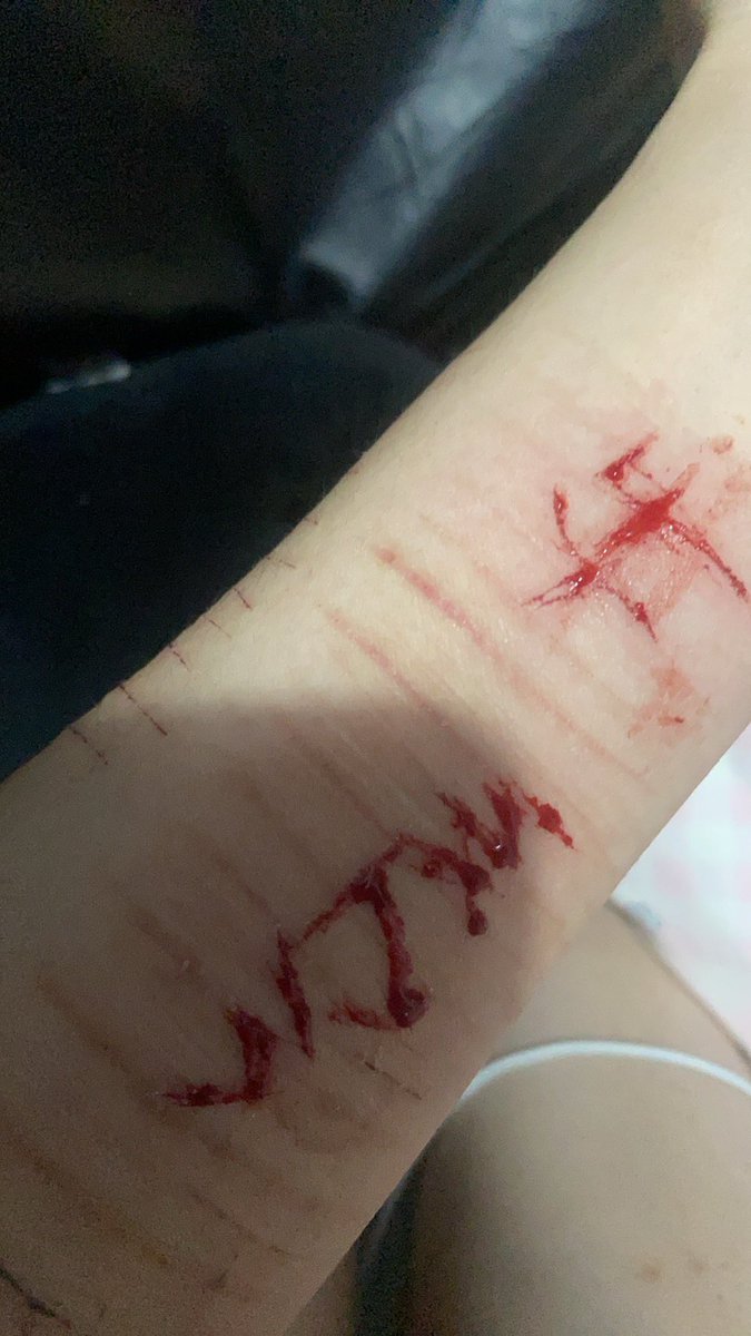 为了没有眼泪的明天 tweet media