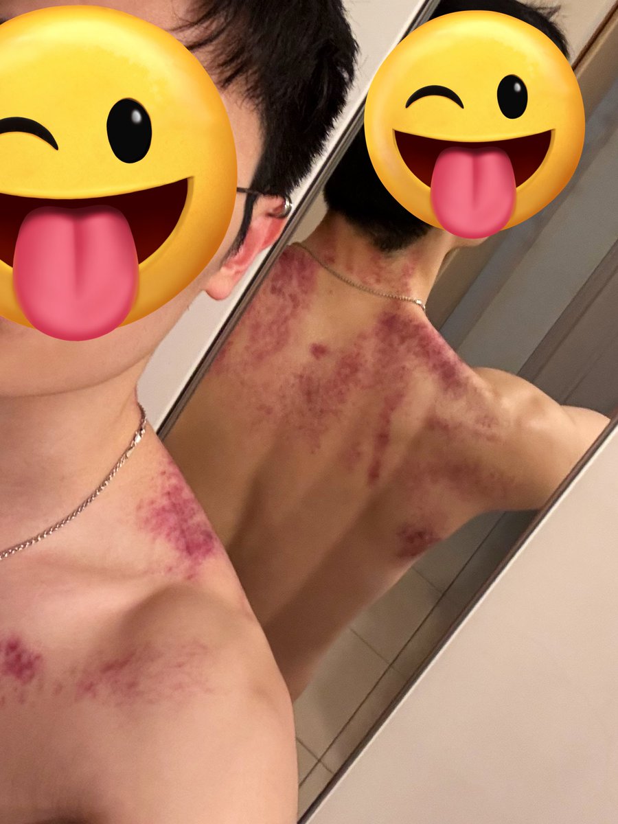 會買醉的🎓🐈 tweet media