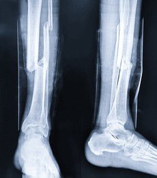 Armance64🩺🐊 tweet media