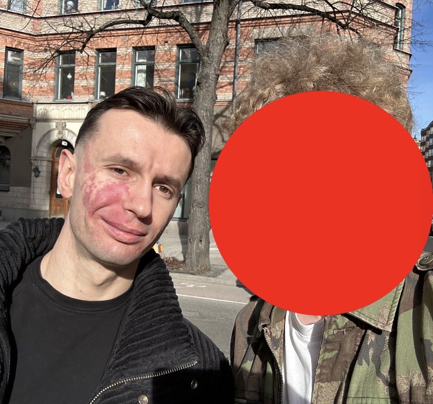 SvanteTB tweet media