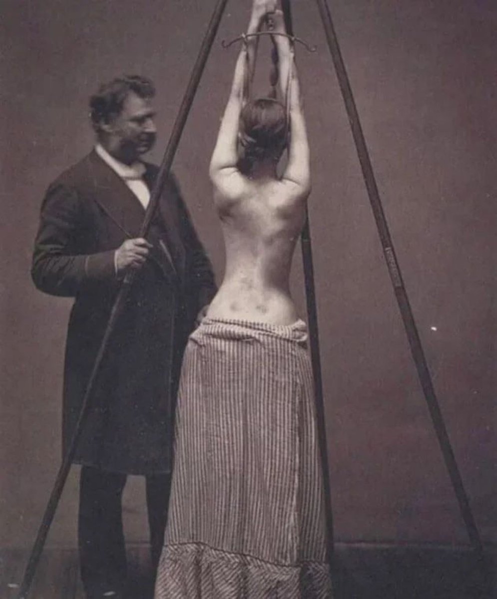 historycalendar's tweet photo. Dr. Lewis Sayre treating scoliosis, checking the curvature of the spine during the 1870s https://t.co/dRkHqQi7g0