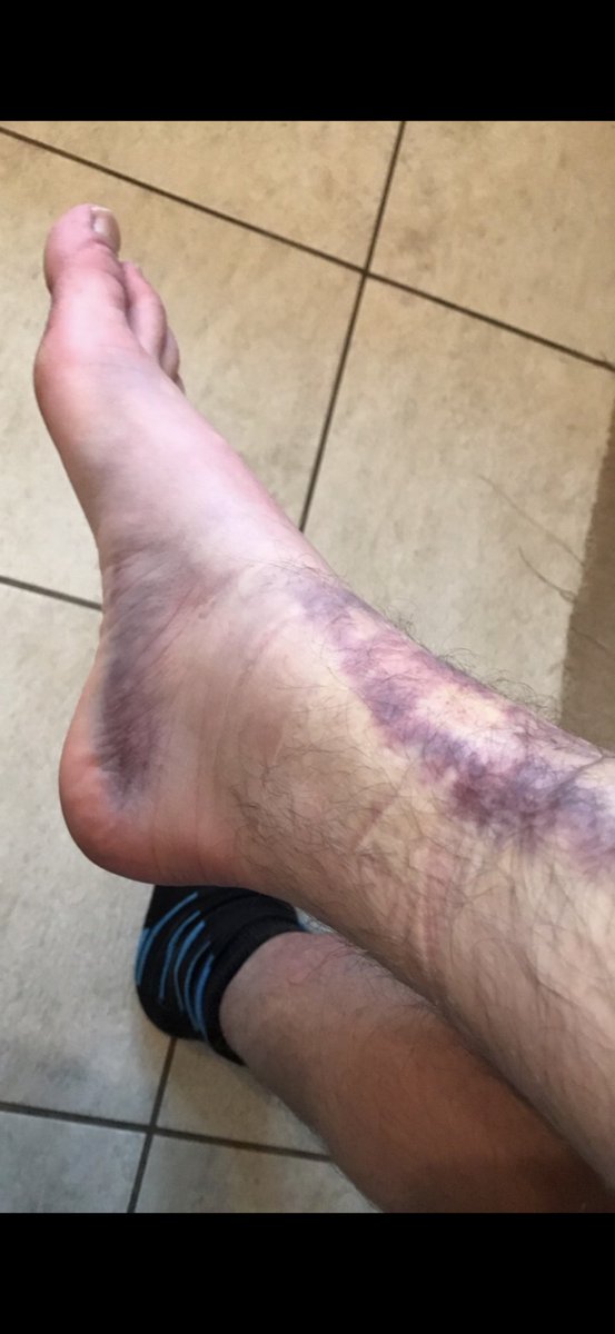 Jack Anderson tweet media