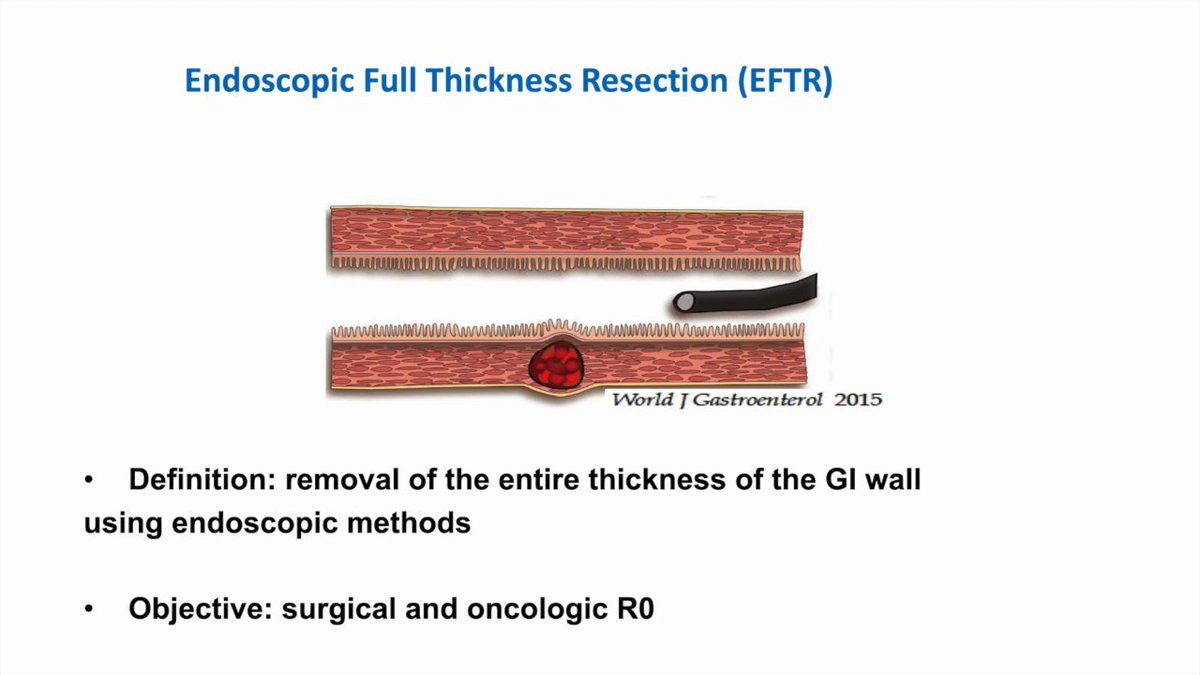 EndoCollab™ | GI Endoscopy Community tweet media