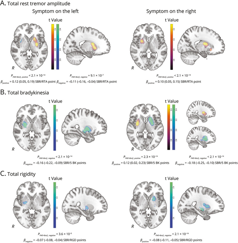 The Science of Parkinson's tweet media