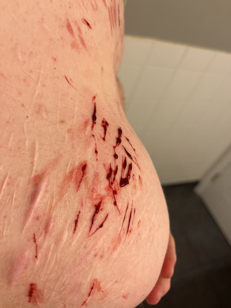 urlocalmetal's tweet photo. Boobie cuts #sh #shtwt #twt https://t.co/73GtrDrhKG