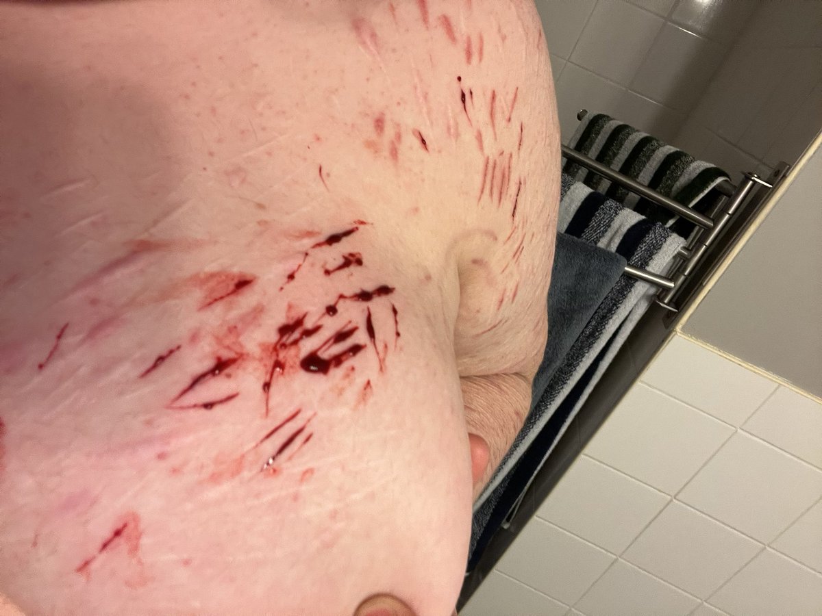 urlocalmetal's tweet photo. Boobie cuts #sh #shtwt #twt https://t.co/73GtrDrhKG