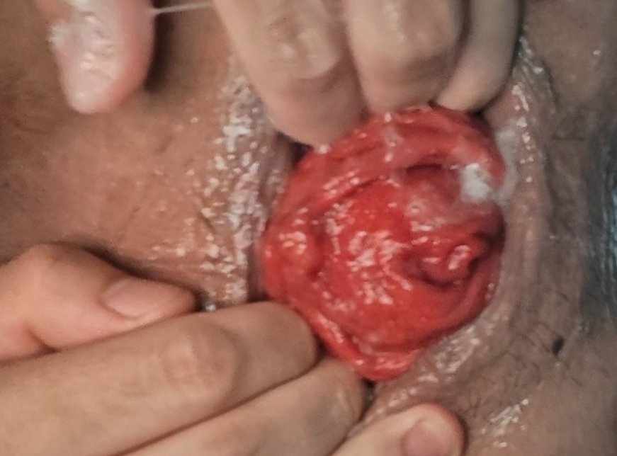 fistingslut tweet media