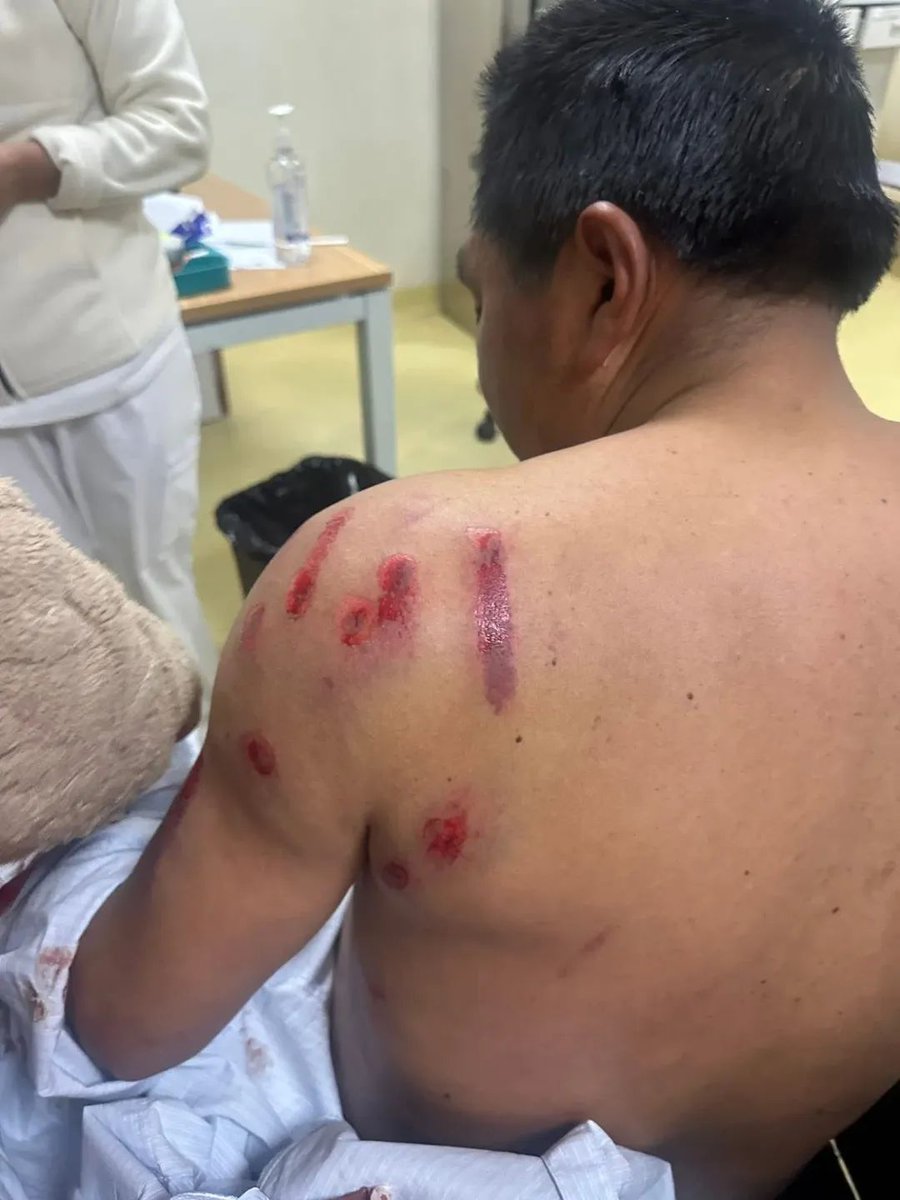 Apawki Castro tweet media