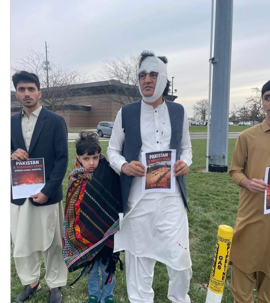 mushtaq_rahim's tweet photo. Afghan journalist Pamir was reportedly assaulted by Pakistanis at a mosque during the Eid congregation in Ohio, United States, while protesting the brutal bombing of a drug rehabilitation center in Kabul on the 27th of Ramadan. https://t.co/wNsFLMTJt4