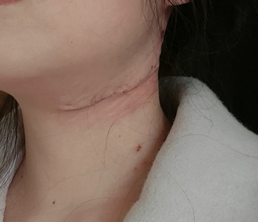 かがり tweet media