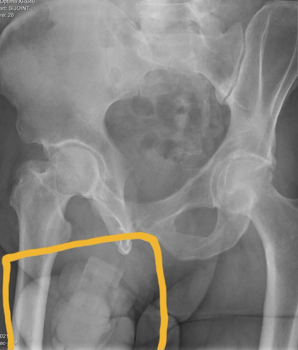 Caged C Ck PDX tweet media