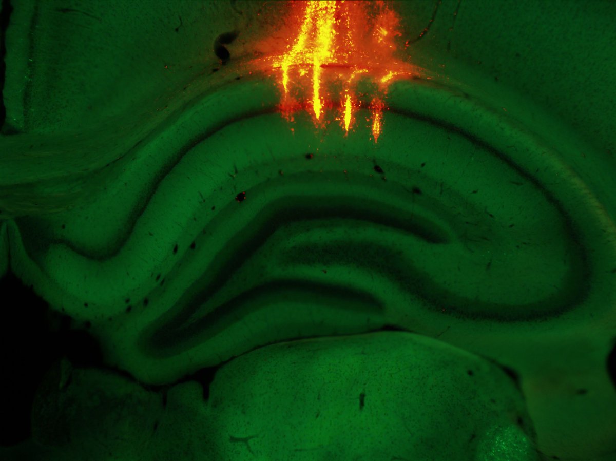 SfNJournals's tweet photo. #SnapshotsinNeuroscience | Featured on the #eNeuro blog from Soma et al. vivid vertical tracks targeting the Cornu Ammonis 1 region of the dorsal hippocampus of a transgenic rat. Photo Credit: Shogo Soma
https://t.co/d6LQMLW75C https://t.co/dep7rmu1Ig