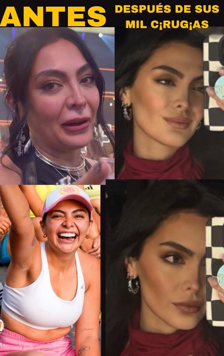 bestofchrist's tweet photo. @fantuvozimporta @erickflowers_ La infiel y víbora Valeria Berganza, es miles de veces peor que Walter, que Samantha, que Agustina, que todos ellos juntos. Su apellido es Berganza pero hasta en eso es falsa, se pone Cuevas porque se avergüenza de su papá. Se operó toda la cara para retener a @christophervele https://t.co/EDWITct0ZF