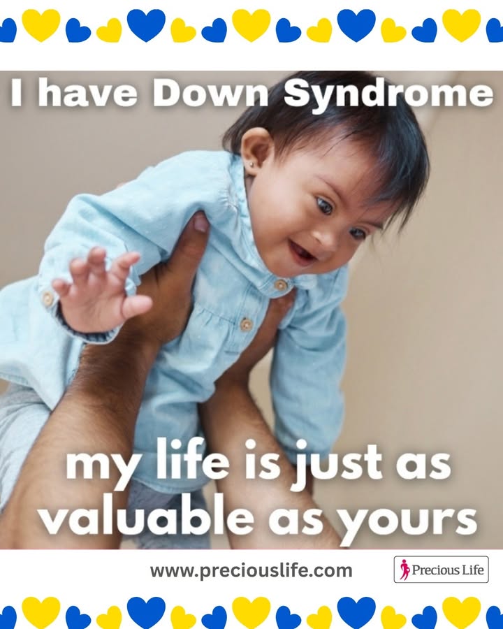 PreciousLifeCom's tweet photo. #WorldDownSyndromeDay #WDSD2026 #dontscreenusout #MakeAbortionUnthinkable https://t.co/iqrEGqpnQ0