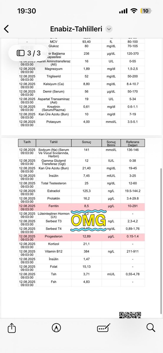 GGalenik's tweet photo. Leyla hanımın tavsiyesinde geçen mineral tuzlara ilave olarak bir de bu fermente sirkeyi öneririm 💐
Danışanımız kasım ayında gelmişti.Ağustostaki kan sonucu ve 2 kutu fermente sirke kullandıktan sonraki şubattaki sonuç :) https://t.co/qSuz07m9QE