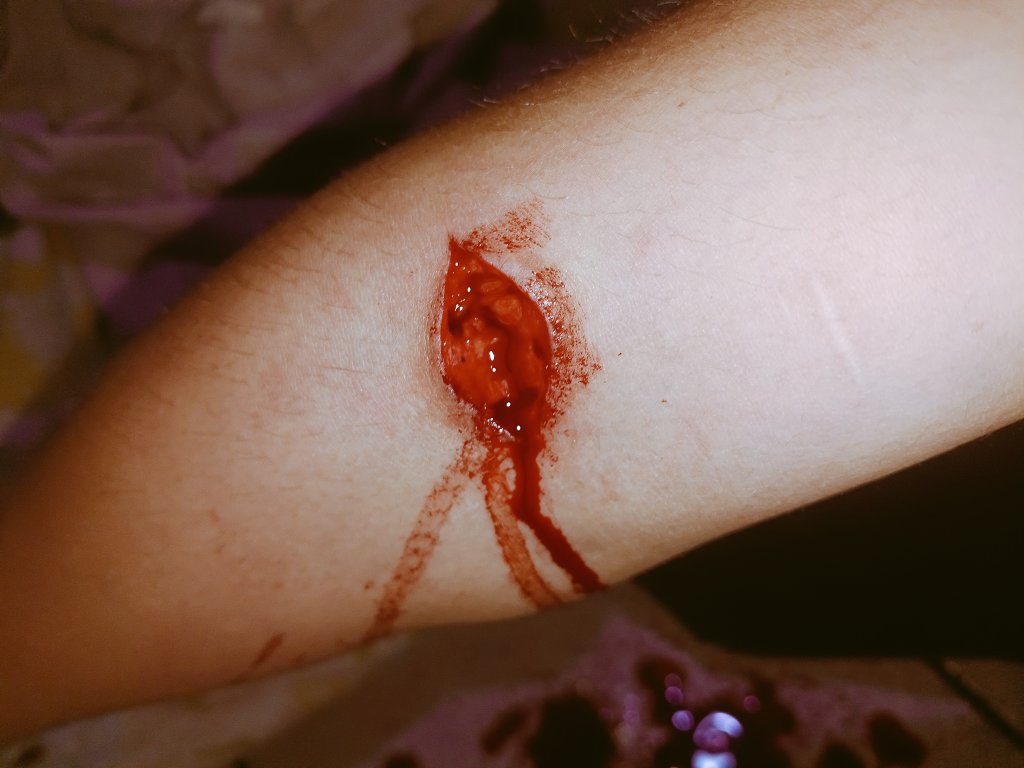 sofistudys's tweet photo. Está otro que si toque vena,es lo lugar más fácil que es conseguido para cortarme las venas rápido,y no tan obvio #beans #shtwt https://t.co/iqh5XNw3Oj