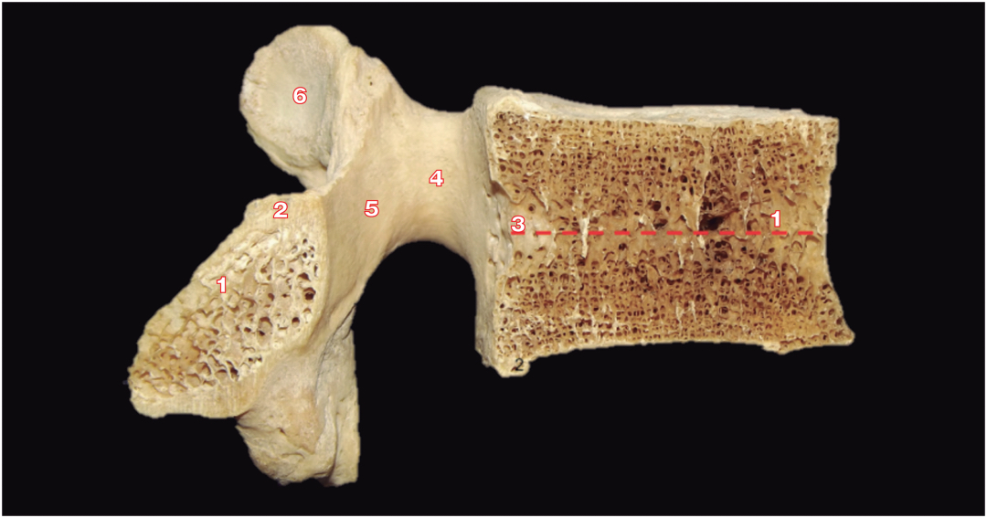 Corte sagital de una #VértebraLumbar
📌1 Tejido óseo esponjoso
📌2 Tejido óseo compacto
📌4 #Pedículo
📌5 #Lámina
📌6 #ApófisisArticularSuperior
📚Anatomía topográfica con aplicación médico-quirúrgica. Elsevier © 2025