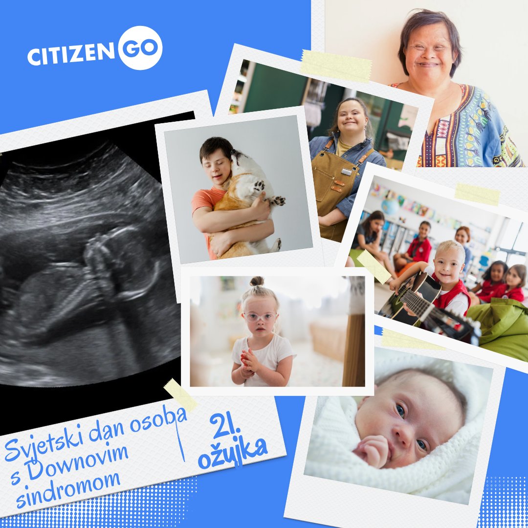 CitizenGO_HR's tweet image. 💙💛 Danas je Svjetski dan osoba s Down sindromom

Svaki život ima vrijednost.
Svaka osoba ima dostojanstvo.
Birajmo prihvaćanje, podršku i ljubav.

#DownSyndrome #WorldDownSyndromeDay