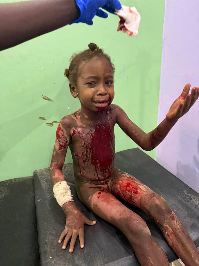 ELFATIH TERBOالفاتح فضل دريسة tweet media