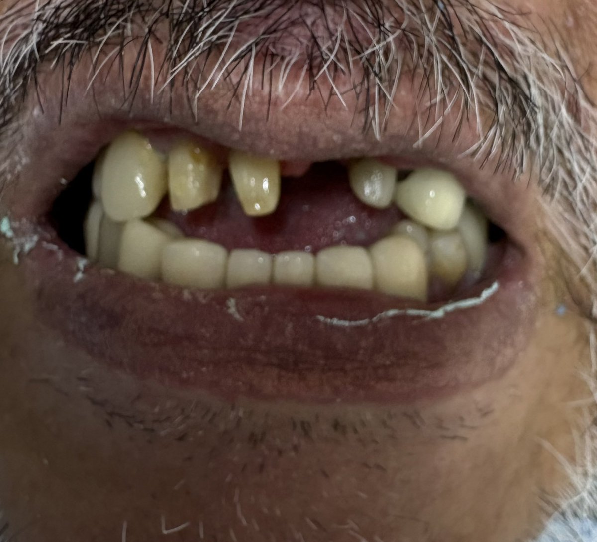 CaRaCony's tweet photo. @En_laDelValle Prepárate para tus vacaciones! Evita dolores de dientes que te las arruinen ! Atiéndete antes,   agenda tu cita en Doctoralia 
https://t.co/P9KsT4Ulhh https://t.co/YKIfnET85k