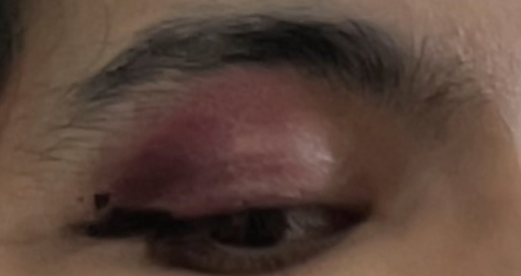 ✧yani✧ tweet media