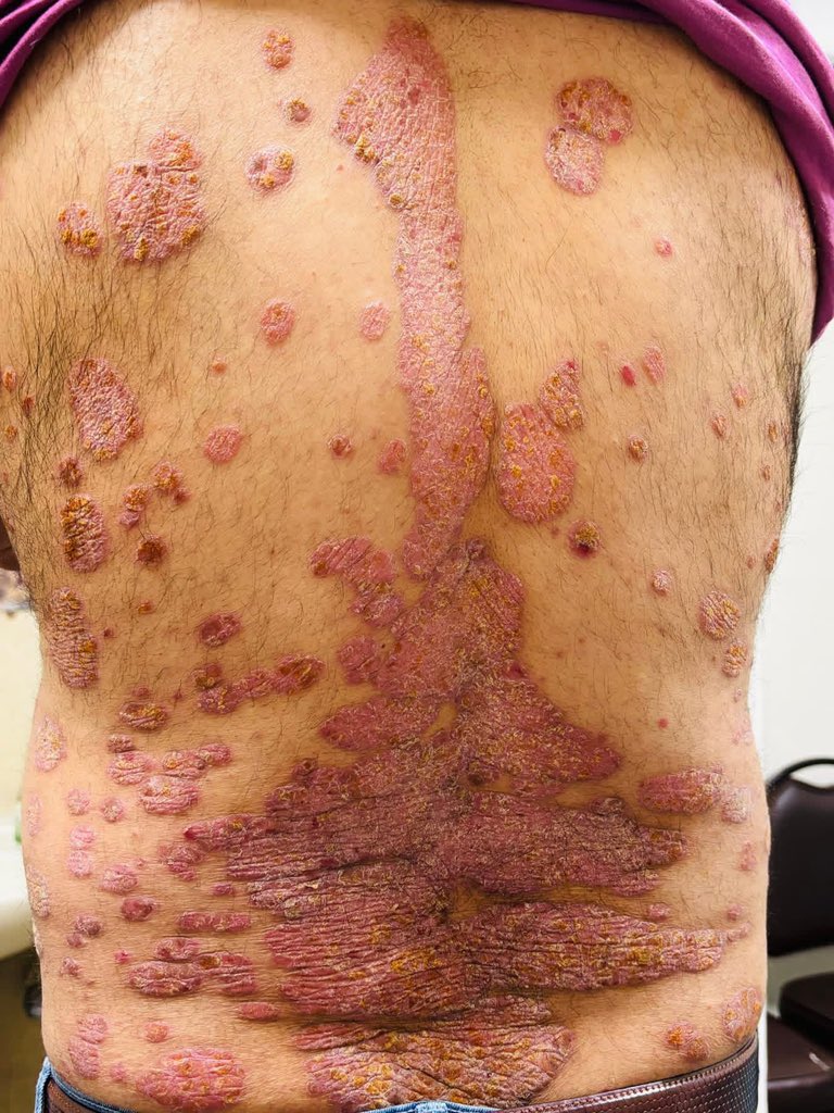 Dr.Haitham Hamoud | د.هيثم tweet media