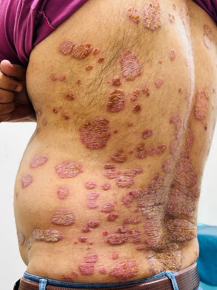 Dr.Haitham Hamoud | د.هيثم tweet media