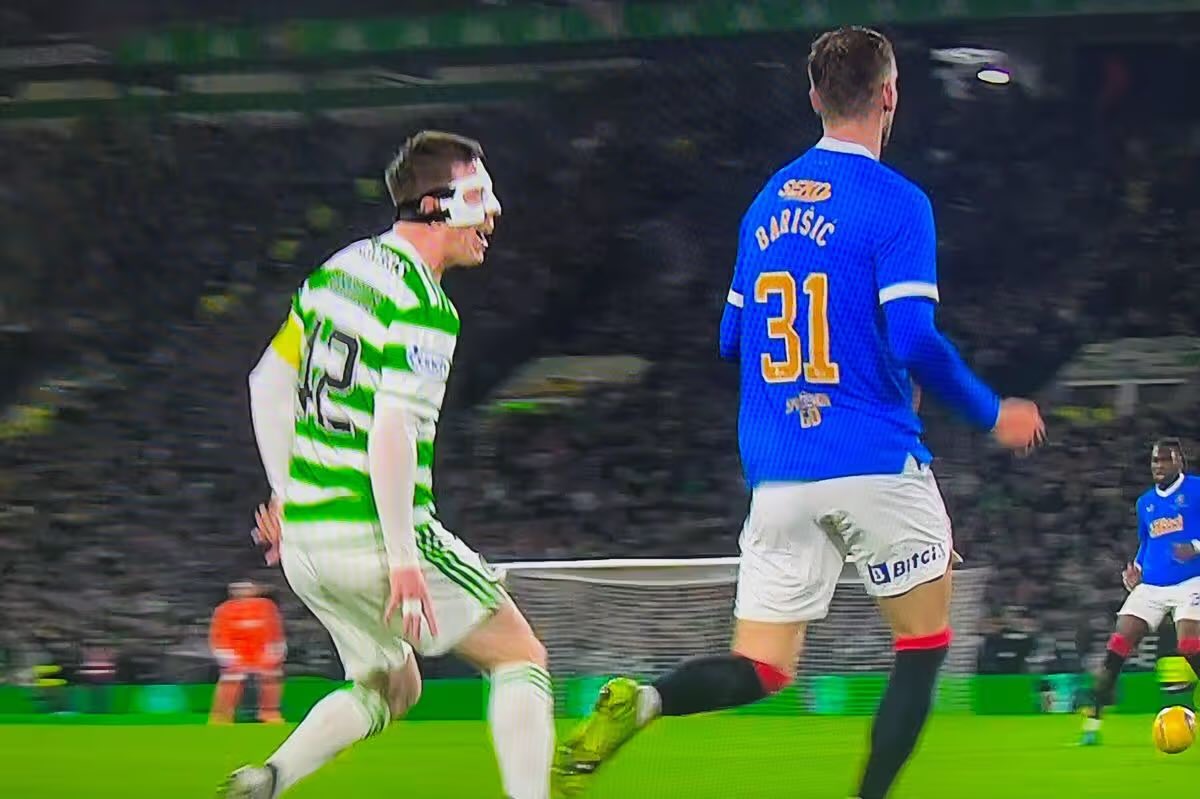 Lewis 🍀 tweet media