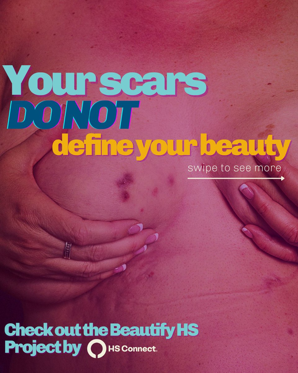 HSconnect.org - HS Connect tweet media