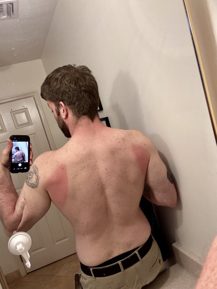 STUMPY💯 tweet media