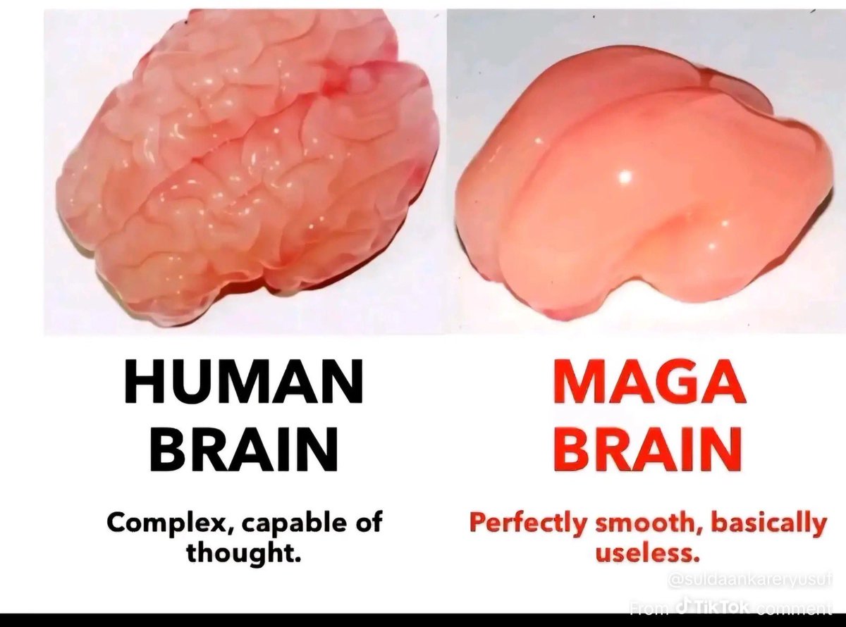 CHIGUY 🇺🇸💙🇺🇦 tweet media