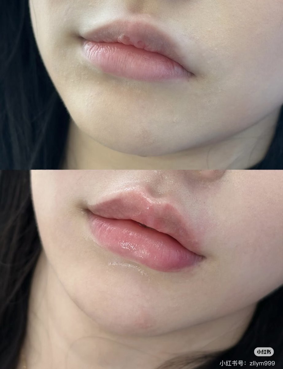 のえる tweet media