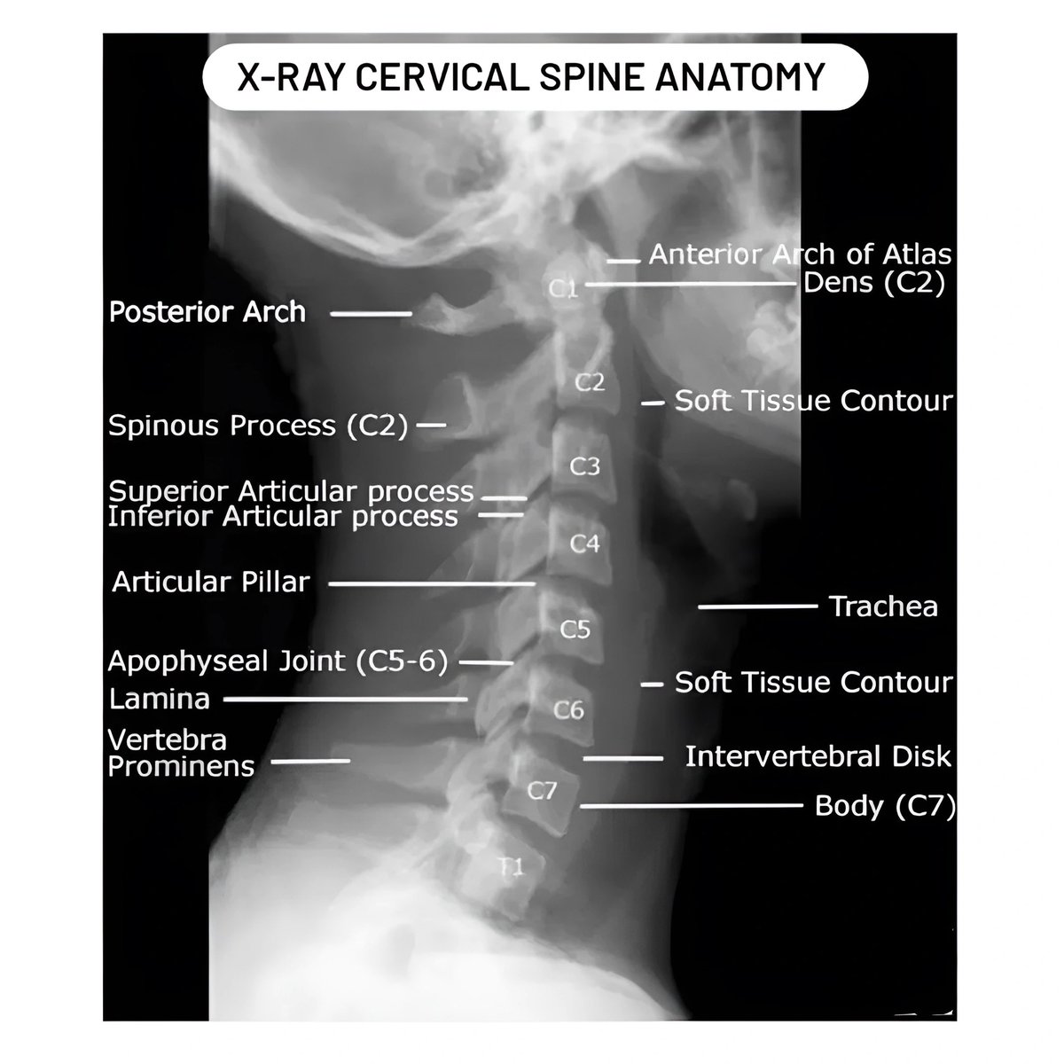 Seraj Ajaj tweet media